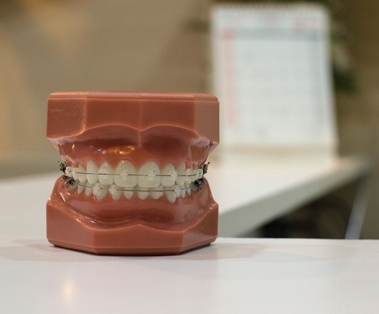 ortodoncja bielsko